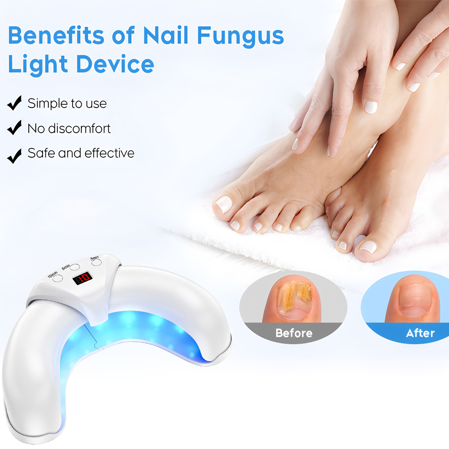 Fungus Laser Treatment Device  - đánh giá và giá Industrial Laser Removal
